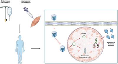 Adeno-Associated Virus (AAV)-Mediated Gene Therapy for Duchenne Muscular Dystrophy: The Issue of Transgene Persistence